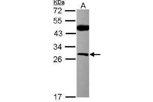 WB Image Sample (30 ug of whole cell lysate) A: MCF-7 12% SDS PAGE antibody diluted at 1:500 (CSNK2B Antikörper)