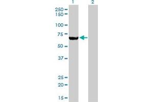 Western Blot analysis of MTMR2 expression in transfected 293T cell line by MTMR2 monoclonal antibody (M03), clone 4G6.