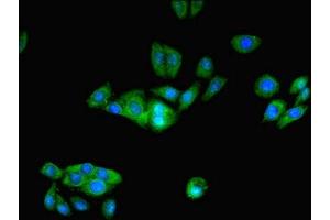 Immunofluorescent analysis of HepG2 cells using ABIN7164206 at dilution of 1:100 and Alexa Fluor 488-congugated AffiniPure Goat Anti-Rabbit IgG(H+L) (PFDN1 Antikörper  (AA 2-122))