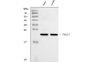 Western blot analysis of TNNI1 using anti-TNNI1 antibody (ABIN7603242).