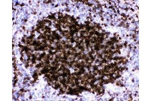 IHC-P: CD23 antibody testing of mouse spleen tissue (FCER2 Antikörper  (AA 50-331))