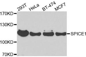 Western blot analysis of extracts of various cells, using SPICE1 antibody. (SPICE1 Antikörper)