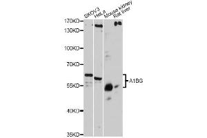 Western blot analysis of extracts of various cell lines, using A1BG antibody. (A1BG Antikörper)