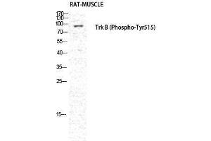 Western Blotting (WB) image for anti-Neurotrophic Tyrosine Kinase, Receptor, Type 2 (NTRK2) (pTyr516) antibody (ABIN3179513) (TRKB Antikörper  (pTyr516))