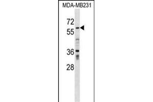 ZN Antibody (N-term) (ABIN1539343 and ABIN2849295) western blot analysis in MDA-M cell line lysates (35 μg/lane). (ZNF543 Antikörper  (N-Term))