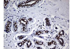 Image no. 2 for anti-Nibrin (NBN) (AA 183-460) antibody (ABIN1491059) (Nibrin Antikörper  (AA 183-460))