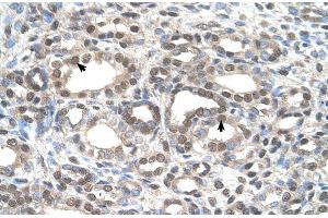Human kidney (DFNA5 Antikörper  (C-Term))