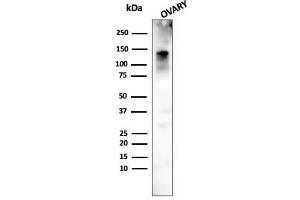 Western Blot Analysis of human Ovary tissue using Caldesmon Mouse Monoclonal Antibody (h-CALD). (Caldesmon Antikörper)