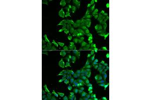 Immunofluorescence analysis of HeLa cells using STOM antibody (ABIN5973779). (Stomatin Antikörper)
