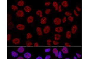 Confocal immunofluorescence analysis of Hela cells using CTCF Polyclonal Antibody at dilution of 1:200. (CTCF Antikörper)