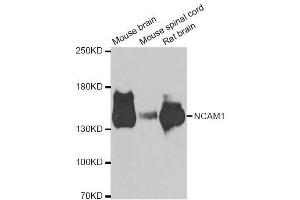 Western blot analysis of extracts of various cell lines, using NCAM1 antibody. (CD56 Antikörper  (AA 759-858))