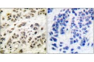 Immunohistochemistry (IHC) image for anti-Myc Proto-Oncogene protein (MYC) (AA 31-80) antibody (ABIN2888572) (c-MYC Antikörper  (AA 31-80))