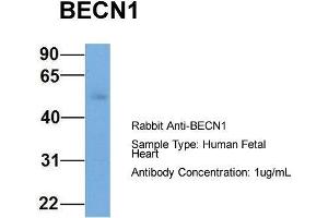 Host: Rabbit  Target Name: BECN1  Sample Tissue: Human Fetal Heart  Antibody Dilution: 1. (Beclin 1 Antikörper  (Middle Region))