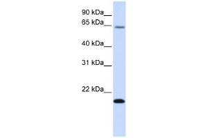 FAM19A3 antibody used at 1 ug/ml to detect target protein. (FAM19A3 Antikörper  (Middle Region))