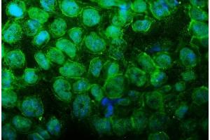 IF analysis of UBR2 using anti-UBR2 antibody (ABIN7599609).