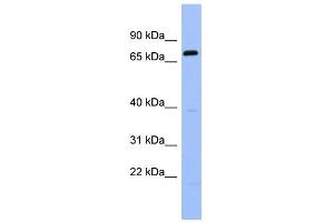 WB Suggested Anti-RGS9 Antibody Titration: 0.