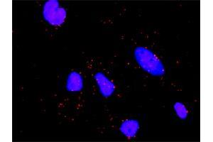 Proximity Ligation Analysis of protein-protein interactions between STK11 and STRADA. (STRADA Antikörper  (AA 251-346))