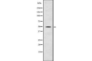 Western blot analysis Fgl2 using Jurkat whole cell lysates (FGL2 Antikörper  (C-Term))