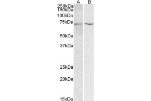 Western Blotting (WB) image for HNF1 Homeobox A (HNF1A) peptide (ABIN368836) (HNF1 Homeobox A (HNF1A) Peptid)