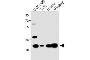 All lanes : Anti-RCH5 Antibody (N-term) at 1:1000 dilution Lane 1: U-251 MG whole cell lysate Lane 2: T47D whole cell lysate Lane 3: Hun heart lysate Lane 4: Mouse kidney lysate Lysates/proteins at 20 μg per lane. (MARCH5 Antikörper  (N-Term))