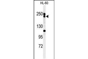 Western blot analysis of BLM Antibody in HL-60 cell line lysates (35ug/lane) (BLM Antikörper  (C-Term))