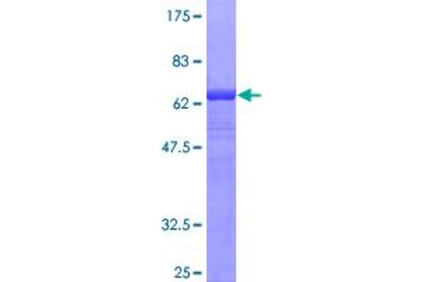 SERPINA3 Protein (AA 1-423) (GST tag)