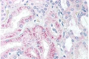 Human Kidney (formalin-fixed, paraffin-embedded) stained with AES antibody ABIN213897 at 5 ug/ml followed by biotinylated goat anti-rabbit IgG secondary antibody ABIN481713, alkaline phosphatase-streptavidin and chromogen. (AES Antikörper  (N-Term))