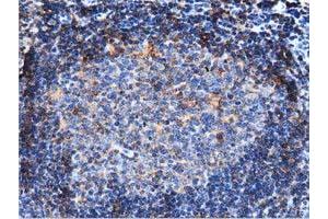 Immunohistochemical staining of paraffin-embedded Human lymph node tissue using anti-ARHGAP25 mouse monoclonal antibody. (ARHGAP25 Antikörper)