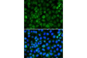 Immunofluorescence analysis of A549 cell using HIST2H4B antibody. (Histone Cluster 2, H4b (HIST2H4B) Antikörper)