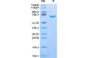 Human IL-22R alpha 1 on Tris-Bis PAGE under reduced condition. (IL22 Receptor alpha 1 Protein (AA 16-228) (Fc Tag))