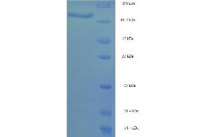 CYP4F11 Protein (AA 38-524) (His-SUMO Tag)