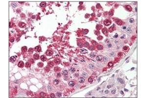 Formalin-Fixed, Paraffin-Embedded Human Testis stained with TSN (Translin Antikörper  (Internal Region))