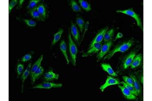 Immunofluorescent analysis of Hela cells using ABIN7173195 at dilution of 1:100 and Alexa Fluor 488-congugated AffiniPure Goat Anti-Rabbit IgG(H+L) (TMEM27 Antikörper  (AA 206-265))