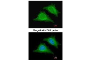 ICC/IF Image Immunofluorescence analysis of paraformaldehyde-fixed HeLa, using AMPK gamma-2, antibody at 1:200 dilution. (PRKAG2 Antikörper  (full length))