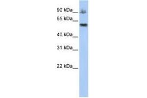 Image no. 1 for anti-Activating Signal Cointegrator 1 Complex Subunit 2 (ASCC2) (AA 612-661) antibody (ABIN6740783) (ASCC2 Antikörper  (AA 612-661))