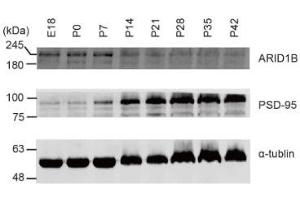 Expression levels of ARID1B protein in WT mouse brains at E18, P0, P7, P14, P21, P28, P35, and P42, as determined by immunoblot analysis of whole-brain lysates.