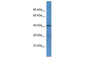 Western Blotting (WB) image for anti-Netrin G1 (NTNG1) (C-Term) antibody (ABIN2788417) (Netrin G1 Antikörper  (C-Term))