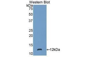 Detection of recombinant S100P using Polyclonal Antibody to S100 Calcium Binding Protein P (S100P) (S100P Antikörper  (AA 1-95))