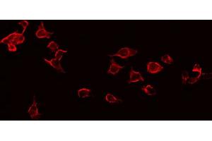 ABIN6268971 staining Hela by IF/ICC. (CD247 Antikörper  (pTyr142))