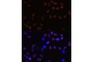 Immunofluorescence analysis of HeLa cells using MCM7 Rabbit mAb (ABIN7268544) at dilution of 1:100 (40x lens). (MCM7 Antikörper)
