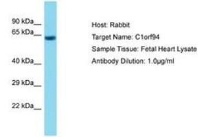 Image no. 1 for anti-Chromosome 1 Open Reading Frame 94 (C1ORF94) (AA 317-366) antibody (ABIN6750714) (C1ORF94 Antikörper  (AA 317-366))