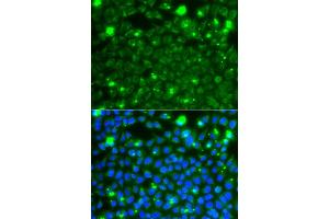 Immunofluorescence analysis of A549 cells using HSPE1 antibody. (HSPE1 Antikörper)
