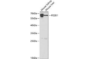 Western blot analysis of extracts of various cell lines, using PDZK1 antibody (ABIN6128428, ABIN6145422, ABIN6145423 and ABIN6220948) at 1:1000 dilution. (PDZK1 Antikörper  (AA 1-260))