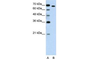 Western Blotting (WB) image for anti-RAR-Related Orphan Receptor A (RORA) antibody (ABIN2462864) (RORA Antikörper)