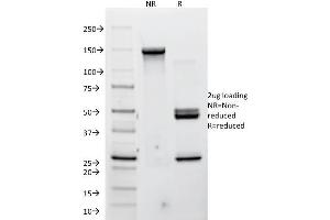 SDS-PAGE Analysis Purified P-Cadherin Mouse Monoclonal Antibody (12H6).