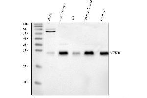 Western blot analysis of RHOB using anti-RHOB antibody (ABIN6719538).