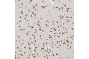 Immunohistochemical staining of human cerebral cortex with NUP153 polyclonal antibody  shows strong nuclear membranous positivity in neuronal cells.