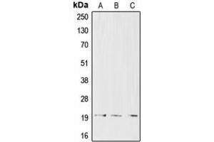 Western blot analysis of CD3d expression in CCRFCEM (A), Jurkat (B), HuT78 (C) whole cell lysates. (CD3D Antikörper  (Center))