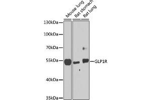 Western blot analysis of extracts of various cell lines, using GLP1R antibody (ABIN6131006, ABIN6141138, ABIN6141140 and ABIN6224643) at 1:1000 dilution. (GLP1R Antikörper  (AA 22-116))