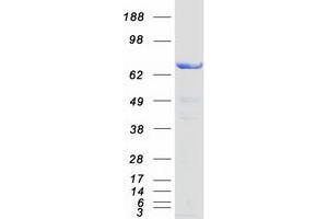 Western Blotting (WB) image for Sorting Nexin 9 (SNX9) protein (Myc-DYKDDDDK Tag) (ABIN2732428)
